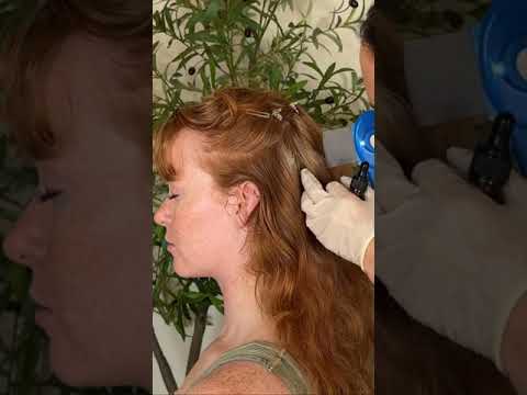Asmr scalp tingles #asmr #asmrsounds #asmrvideo #relax #relaxing #satisfying #hair #sleep #tingles