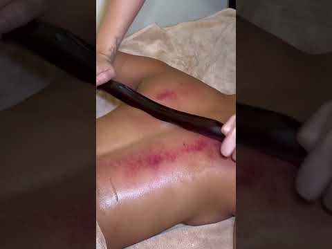 ASMR: STRONG and PAINFUL Chinese BACK Guasha Massage with a STICK! #shorts