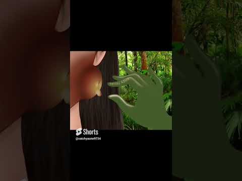Pus removal animation|| ASMR|| #asmr #stopmotionanimation #treatmentanimation  #stopmotionanimation