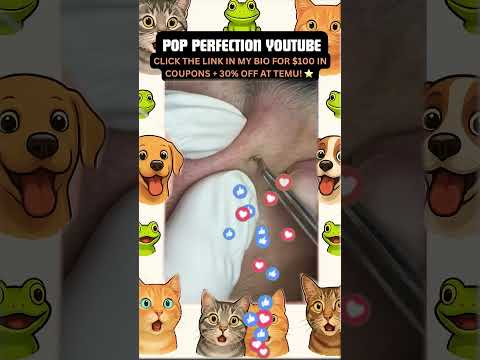 Wow! #pimpleremoval #pimple #pimples #shortsfeed #shortvideo #shorts #short #youtube #youtubeshorts