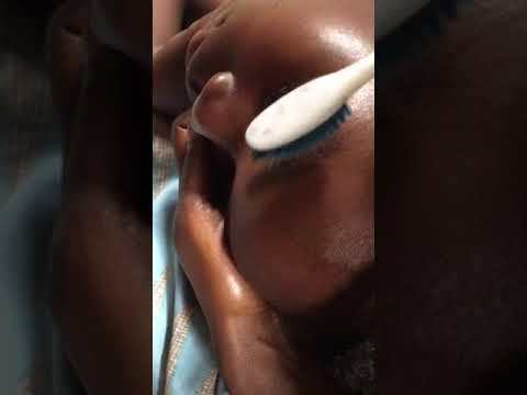 Asmr scratching dandruff for sound sleep. #scratch #dandruff #sound