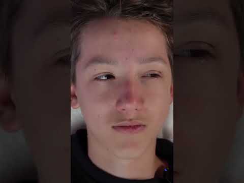 Ultimate Facial Treatment Device #shorts