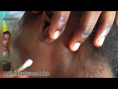Asmr Deep Ear-cleaning , For Relaxation. #asmr #earwaxremoval #asmrcommunity