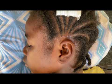 ASMR EAR CLEANING AND PICKING, INTENSE HEAD MASSAGE AND SCALP SCRATCHING FOR SLEEP