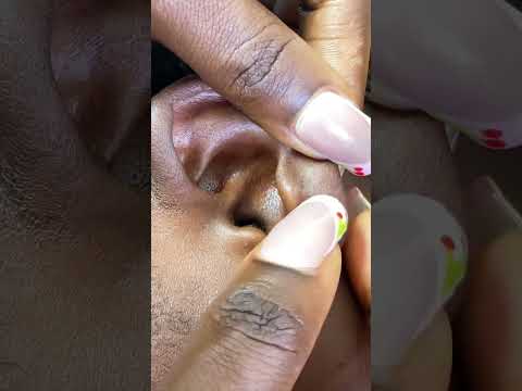 ASMR EAR CLEANING FOR SLEEP #asmr #satisfying #tingling #relax #asmrvideos