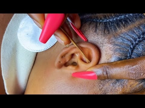 ASMR ✨INTENSE EAR CLEANING