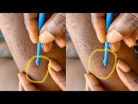 ASMR LEG NITPICKING FOR THOSE WHO WANT TO SLEEP