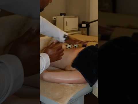 Así me quitan el dolor de espalda: electroacupuntura y masaje intenso en un spa de Caracas #short