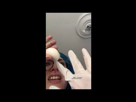 ASMR 1⭐️ doctor gets something out your eye 👀👀