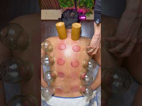 ASMR CUPPING 😍#shorts #viral #trending #trendingshorts #youtubeshorts