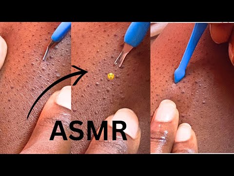 ASMR LEG NITPICKING FOR Good TINGLES