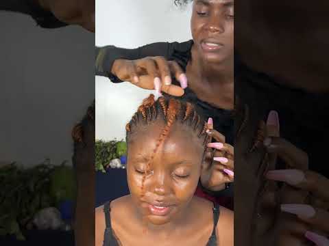 Ultimate ASMR: Scalp Oiling, Braids Scratching & Relaxing Head Massage