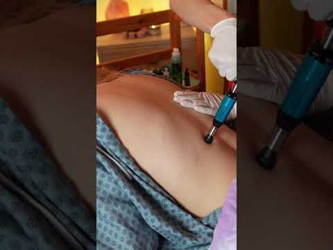 Asmr back exam #asmr #asmrsounds #asmrvideo #relaxing #relax #satisfying #satisfyingvideo #tingles