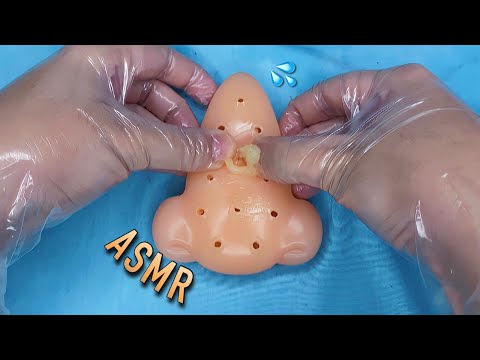 ASMR: ESPREMENDO SUAS ESPINHAS | Popping Squeeze