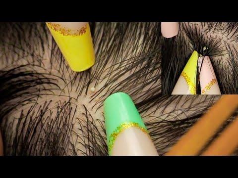 ASMR | Super Attentive NITPICKING Triggers for Sleep 😴 ~ soft whispers