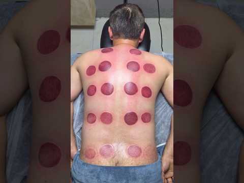 "asmr"pizza cupping alinezhad😍#fyp #shorts #asmr #youtubeshorts #cupping #explore #viral #nyc