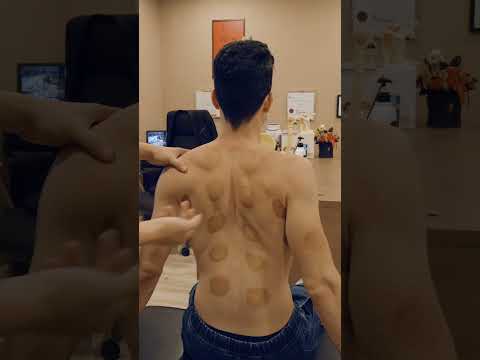ASMR: Chiropratico VS Dolori al Collo e Schiena #shorts