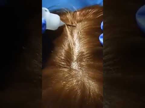 ASMR Scalp Treatment (Close Up) #shorts