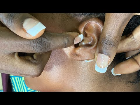 ASMR  Super Attentive deep ear cleaning A LOT OF TINGLES-BUBBLEGUM CRACKING