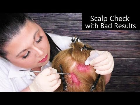 ASMR Scalp Check with Bad Results (Scalp Treatment, Whispering, Scalp Massage) Medical Roleplay