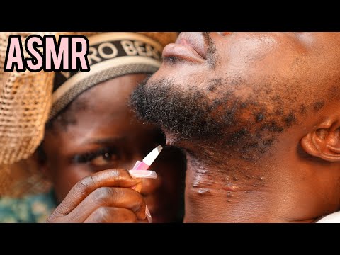 ASMR relaxing beard nitpicking,neck massage,no talking ingrown hair pullout, ear and nape massage 