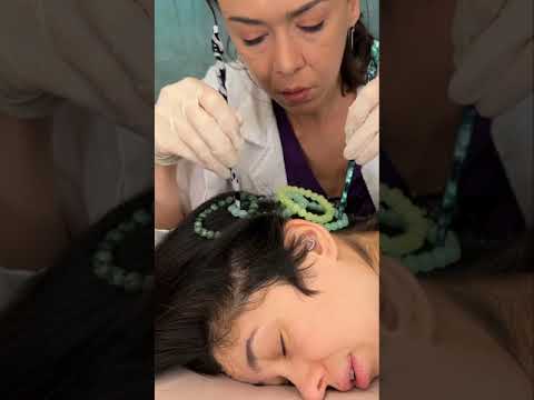 Asmr scalp tingles #asmr #asmrsounds #asmrvideo #relax #relaxing #satisfying #hair #sleep #tingles