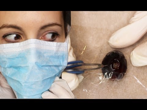 SHE DID SURGERY ON A GRAPE - ASMR