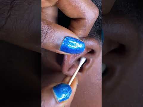 Asmr a rare deep ear cleaning #satisfying #asmr #sleepsounds #relax