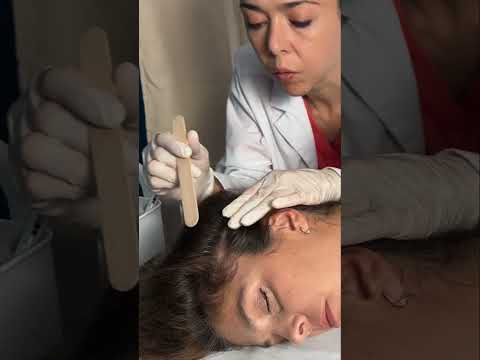 Asmr scalp tingles #asmr #asmrsounds #asmrvideo #relax #relaxing #satisfying #hair #sleep #tingles