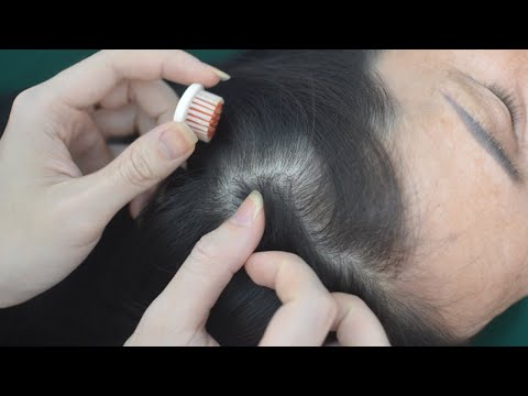 ASMR Nape And Head Scratching Massage, Hair Sounds Tingly For Headache Relief