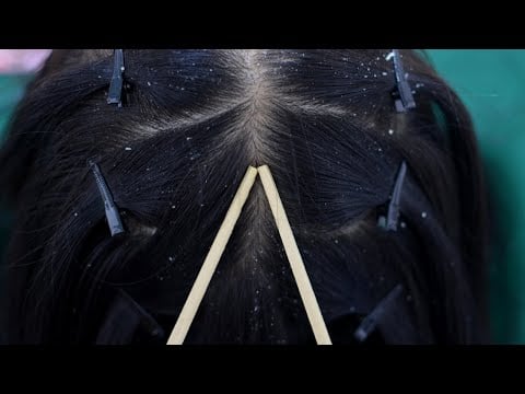 ASMR Relaxing Scalp Check, Scalp Scratching Fast And Aggressive With Chopsticks No Talking