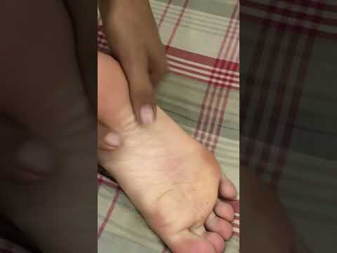 #legmassage #foot #pakistanibestmassage #asmrsounds #massagetherapy #woodentool #satisfying #relax
