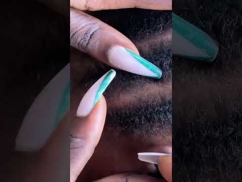 Dandruff scratching on braids #tingling #asmr #nails #satisfying #skincare