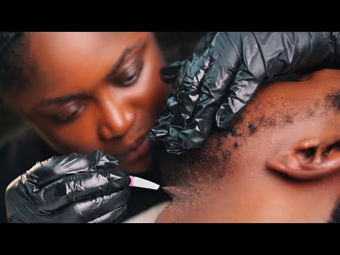 ASMR✨Intense Beard Scratching & Neck Massage (Ingrown Hair Removal + Nitpicking)4 Deep Sleep.+Gum