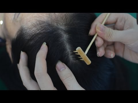 ASMR Hair Parting, Scalp Scratching Real Person, Scalp Massage Sounds For Relieve Headache, Stress