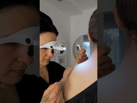 Skin check using specialized glasses