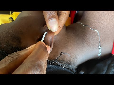 ASMR EAR PICKING AND CLEANING FOR SLEEP WITH CHEWING GUM SOUND IN YOUR EARS