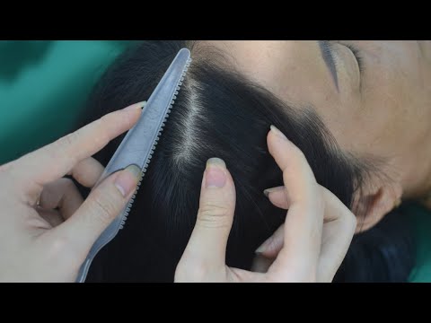 ASMR Scalp Scratching, Scalp Massage Real Person, Tingly For Relieve Stress, Headache ( No Talking )
