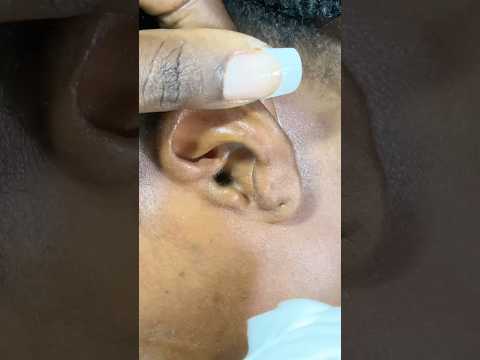ASMR EAR PICKING & PAMPERING TO HELP You SLEEP #earpicking #earcleaning #asmr #relax