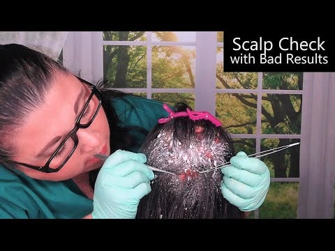 ASMR Scalp Check with Bad Results (Dandruff Removal, Scalp Treatment, Whispering) Medical Roleplay