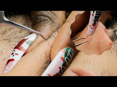 ASMR Beard & Face NITPICKING, scratching & brushing ~ FOR SOFT SLEEP ☁️