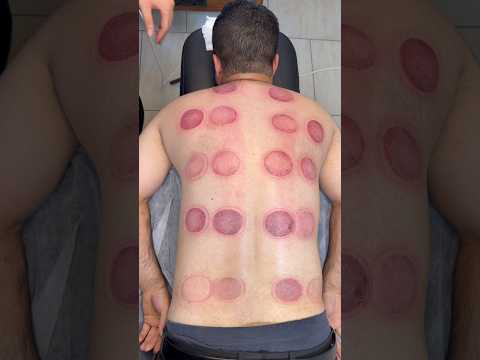 "asmr" vip cupping#fyp #viral #viralshorts #shorts #explore