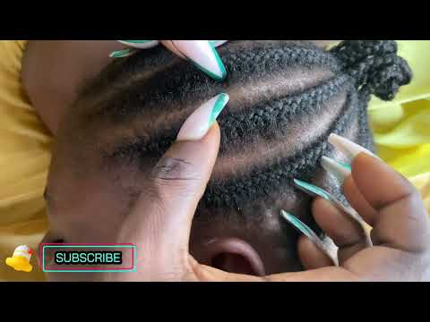 removing scratching dandruff from scalp asmr