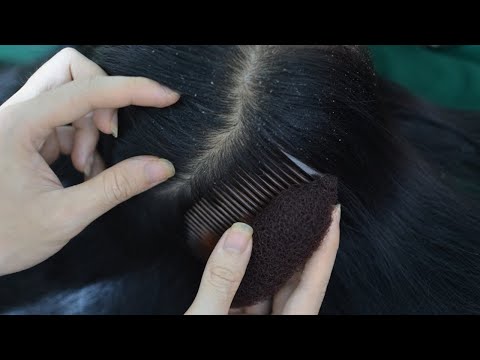 ASMR Scalp Scratching, Scalp Massage On Real Person With Comb Relaxing For Seep ( No Talking )