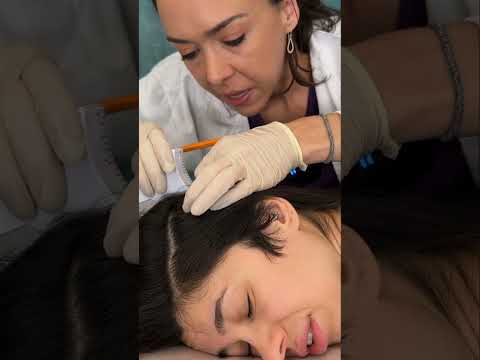 Asmr scalp tingles #asmr #asmrsounds #asmrvideo #relax #relaxing #satisfying #hair #sleep #tingles
