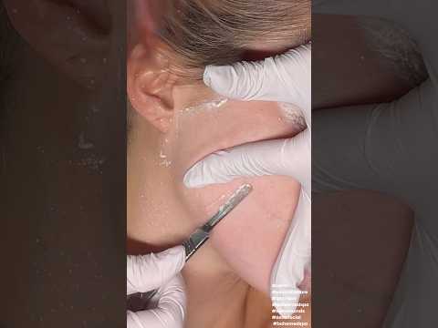 ASMR Dermaplaning