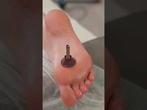 Painful foot massage for Eveline #footmassage
