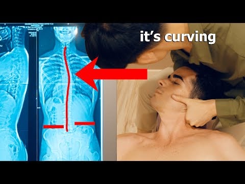 ASMR: Chiropratico Sistema la Mia SCOLIOSI e dolori al COLLO con dei MEGA CRACK!