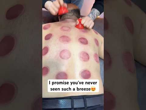 "ASMR"ViP Cupping Alinezhad#shorts #massage #viralshort #youtubeshorts #asmr #cupping