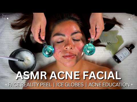 How to Fix Severe Acne: Medical ASMR Facial (Before & After)
